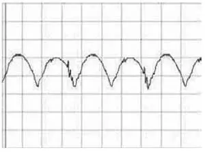 Осциллограмма напряжения на резисторе R312 (R313), пропорционального току ламп (1 В/дел — по вертикали, 5мкс/дел — по горизонтали)